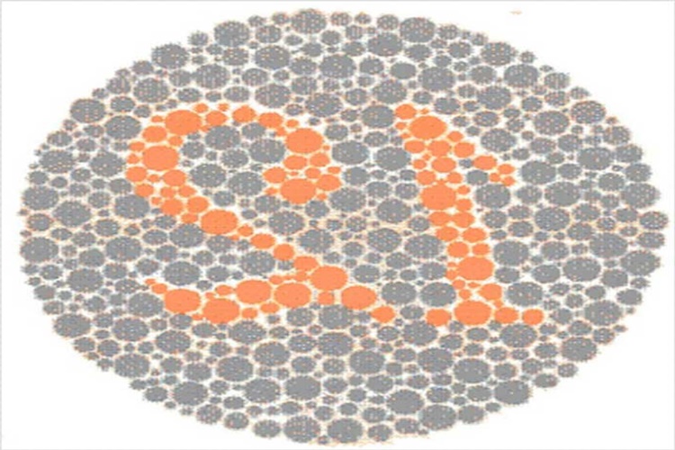 Renk Körlüğü Tedavisi Nedir?