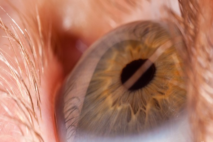 Retina Nedir?