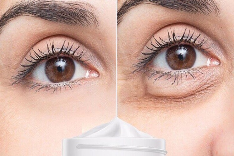 Retinol Serum Göz Çevresine Sürülür Mü?