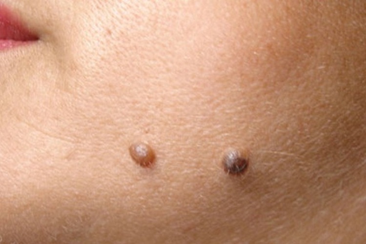 Rüyada Ben Görmek Ne Anlama Gelir?