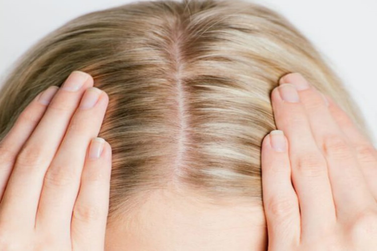 Saç Dipleri Yanarsa Ne Olur?