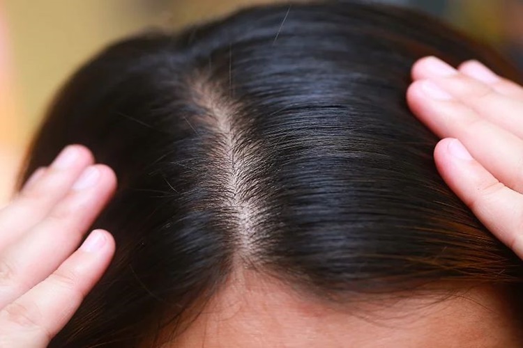 Saç Köklerinin Canlı Olduğunu Nasıl Anlarız?