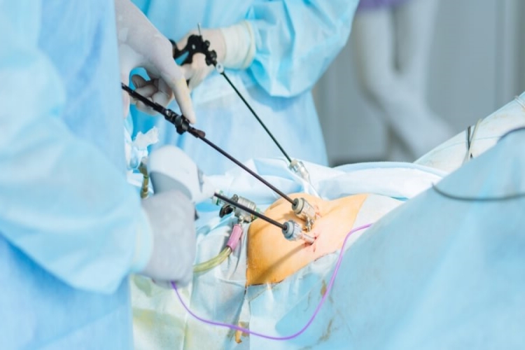 Safra Kesesi Ameliyatı Sonrasında Dikkat Edilmesi Gerekenler?