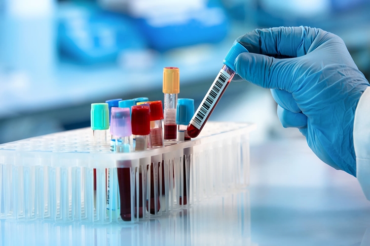 Sağlık Ocağında Kan Tahlili Aç Karnına Mı Yapılır?