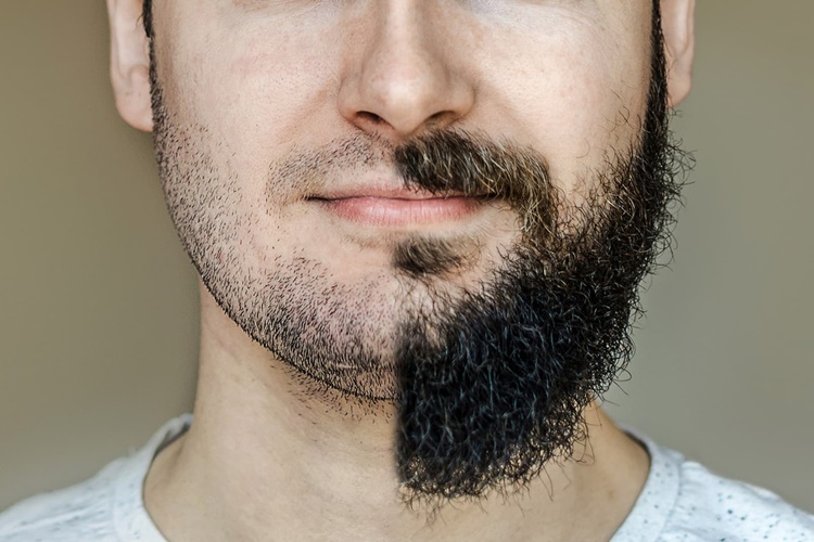 Sakal Serumu İşe Yarıyor Mu?