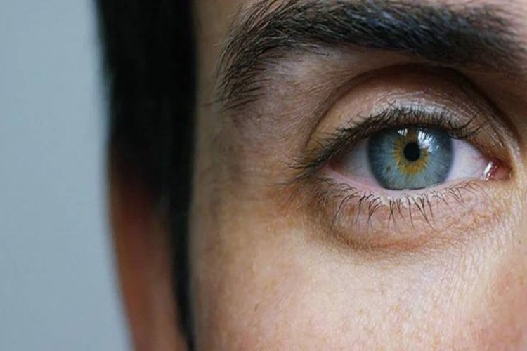 Sarı Nokta Hastalığı (Makula Dejenerasyonu) Nedir?