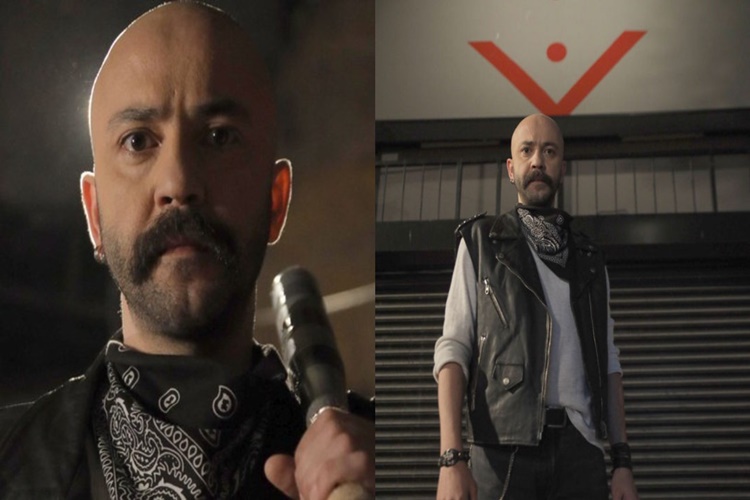 Sarp Akkaya Saç mı Ektirdi?