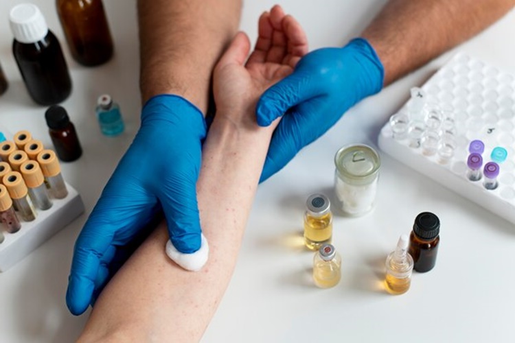 Şeker Alerjisi Testi Nasıl Yapılır?