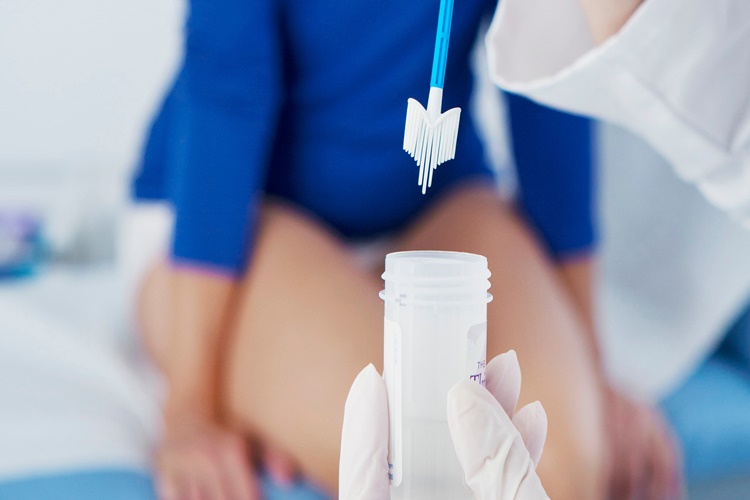 Smear Testi Düşüğe Neden Olur Mu?