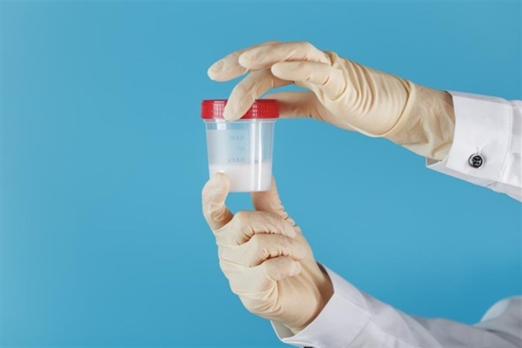 Sperm Testi Aç Karnına Mı Yapılır?