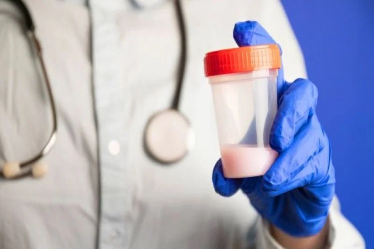Sperm Testi Neden Yapılır?