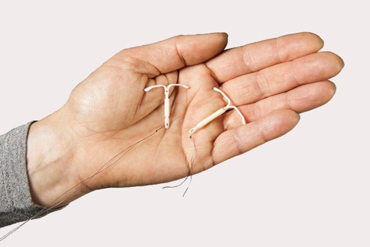 Spiral Varken Tampon Kullanılır Mı?