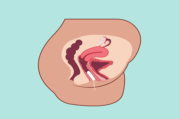 Tampon Nasıl Takılır? 