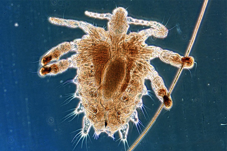 Tavuk Biti Isırığı Tehlikeli Mi?