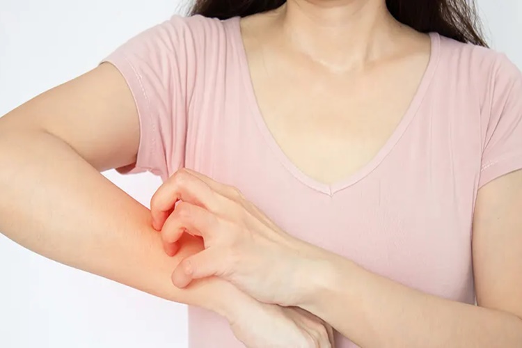Thyromazol Kaşıntı Yapar Mı?