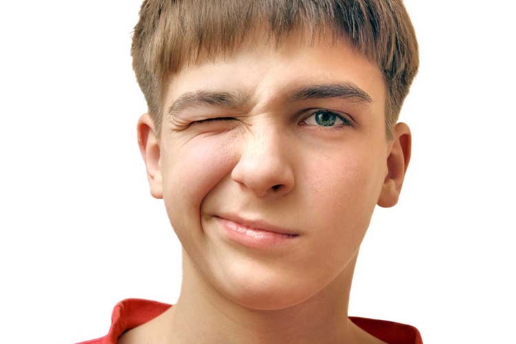 Tik Bozuklukları Nedir?
