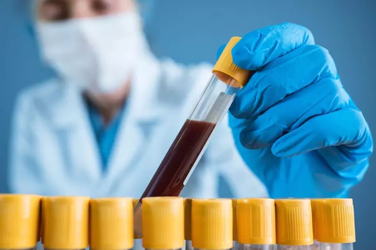 TPHA Testi Neden Yapılır?