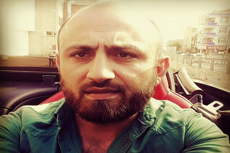 Ünal Turan Saç Mı Ektirdi?
