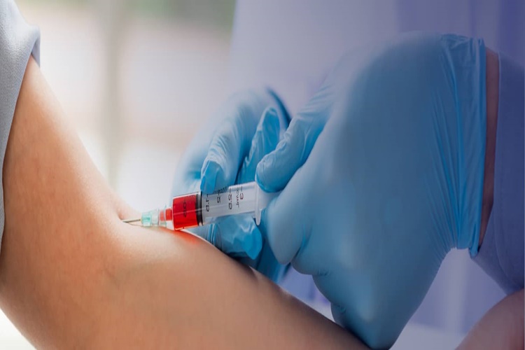 Valproik Asit Testi Aç Karnına Mı Yapılır?