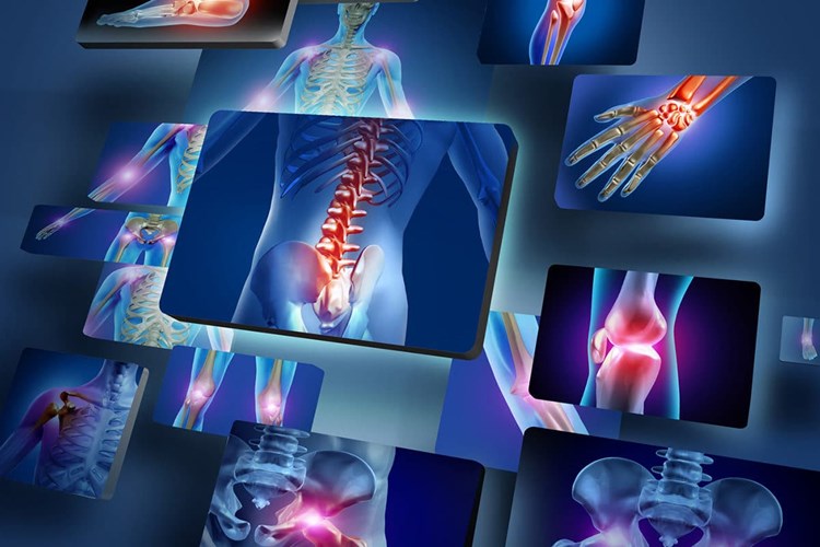 Vitamin Eksikliği Eklem Ağrısı Yapar Mı?