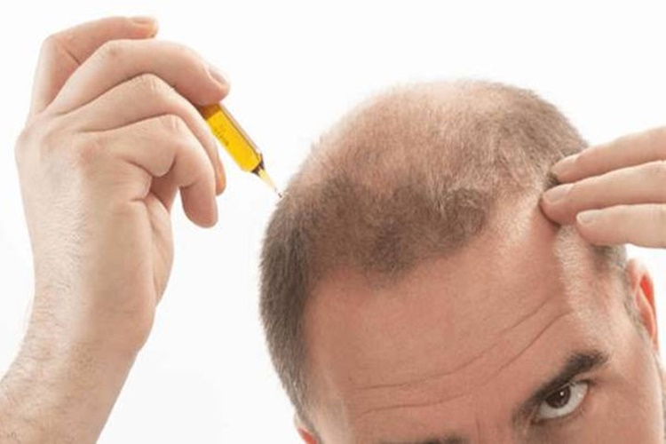 Vitamin Saç Çıkarır Mı?