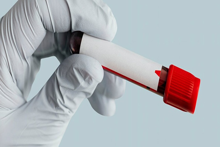 Vitamin Testi Aç Karnına Mı Yapılır?