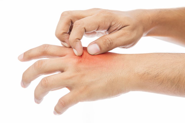 Voltaren Krem Yanığa İyi Gelir Mi?