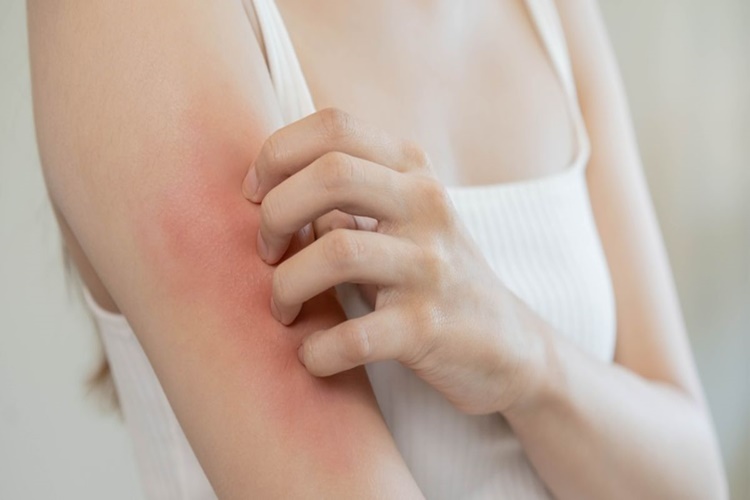 Vücutta Kaşıntı Hangi Vitamin Eksikliğinden Olur?