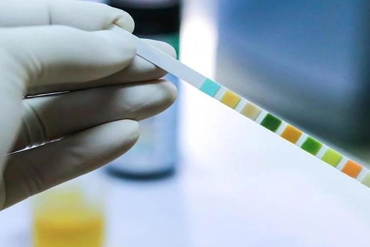 Yediklerimiz İdrar Rengini Etkiler Mi?