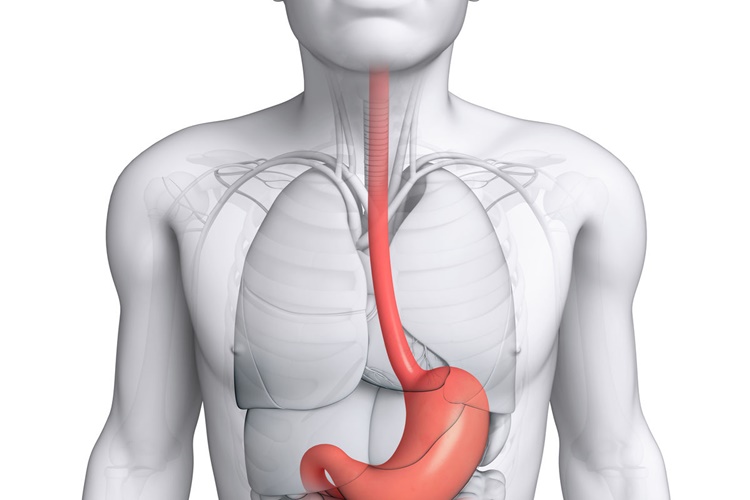 Yemek Borusuna Stent Takıldıktan Sonra Pıhtı Atması Nasıl Geçer?
