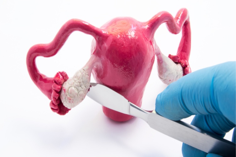 Yumurtalık Kisti Dışarıdan Belli Olur Mu?