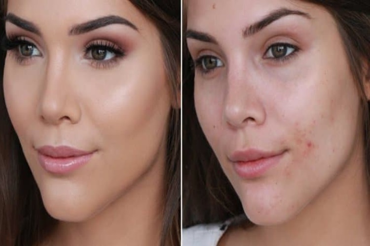 Yüz Kusurları Giderici Maske Önerileri Nelerdir?