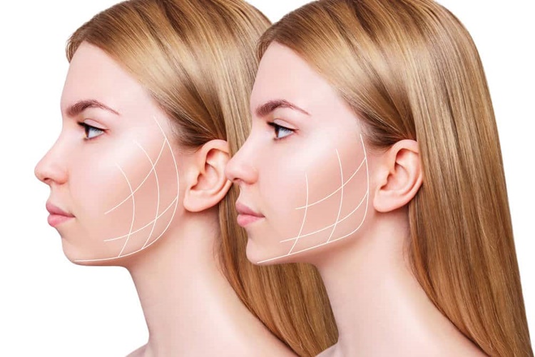 Yüzdeki Dolgu Ne Zaman Erir? Güncel Oku