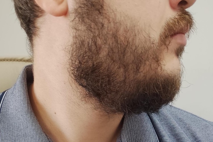 Zoretanin Sakal Çıkarır Mı?